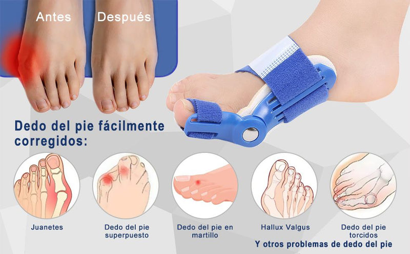 Bunion Corrector Blue™- ¡Recuperar Tu Paso Firme!- (Liquidación por cierre)