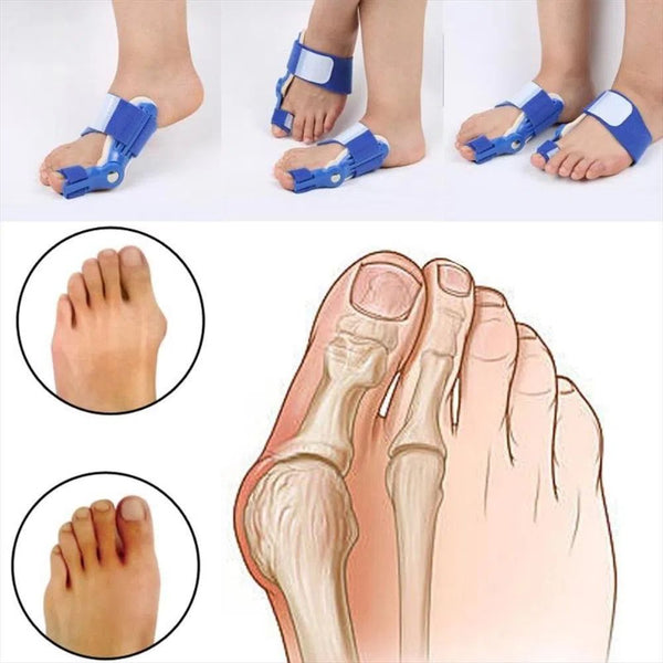 Bunion Corrector Blue™- ¡Recuperar Tu Paso Firme!- (Liquidación por cierre)